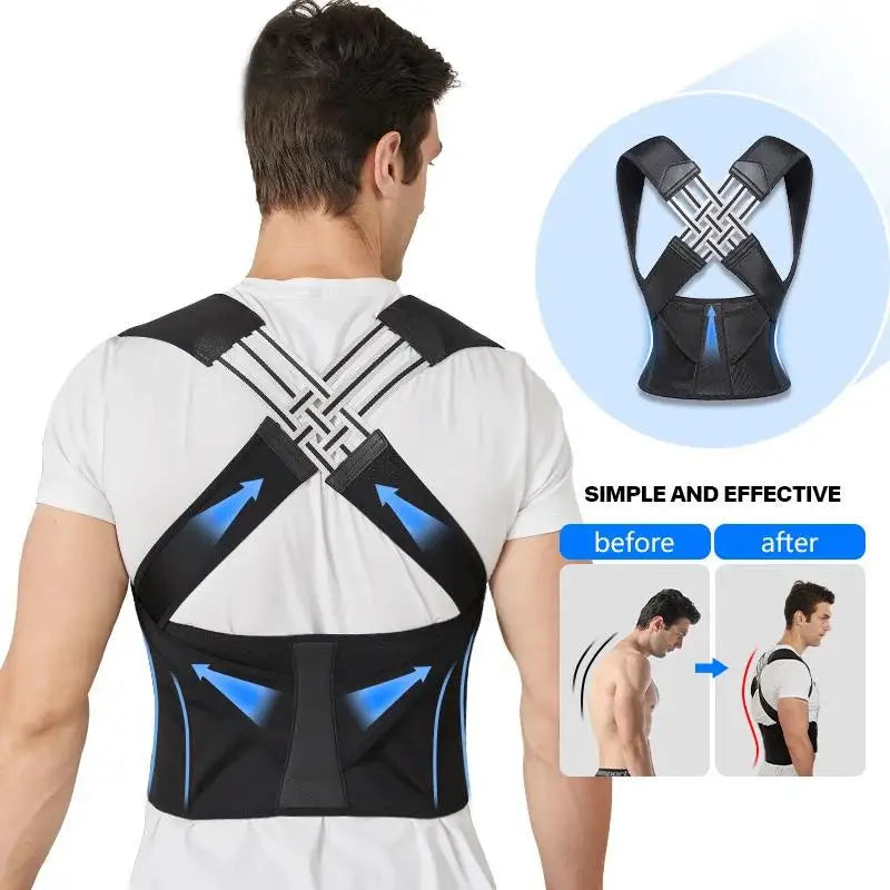 AlignPro Posture Corrector — Adjustable Back Support Brace